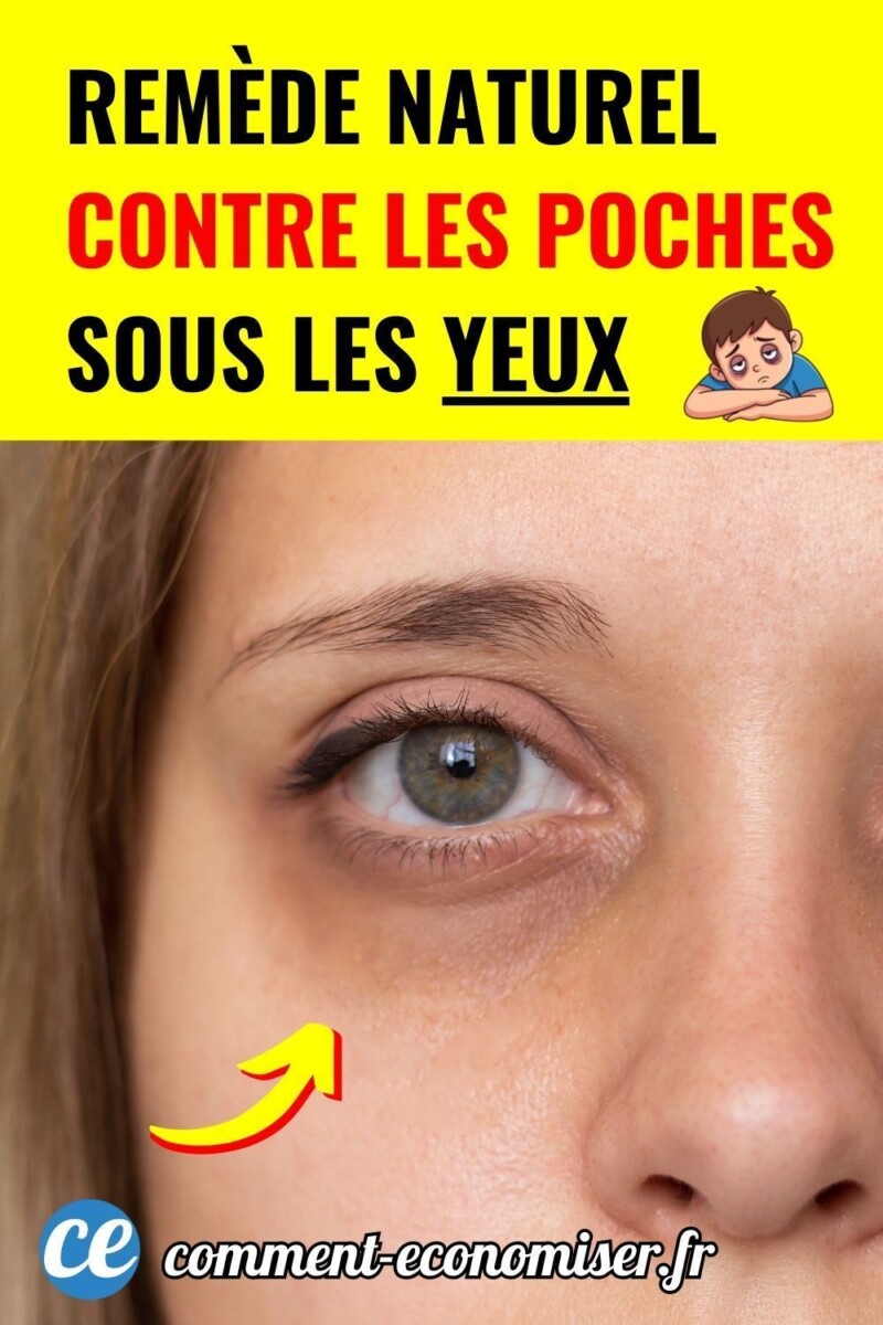 rem&egrave;de paupi&egrave;res gonfl&eacute;es