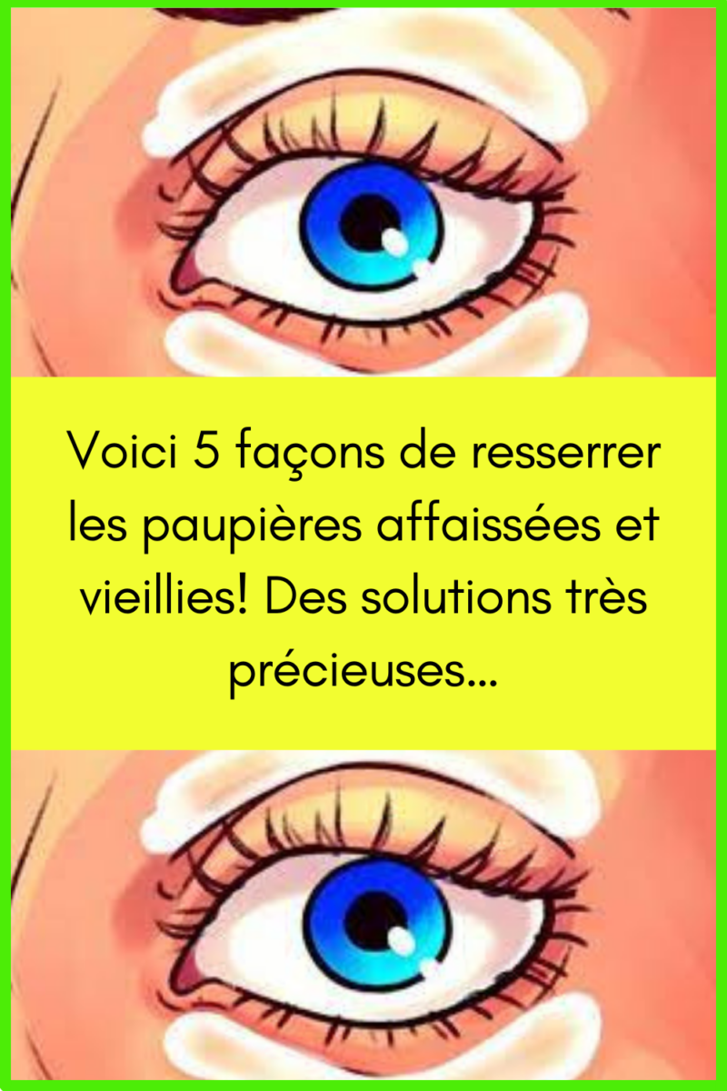 rem&egrave;de paupi&egrave;res gonfl&eacute;es