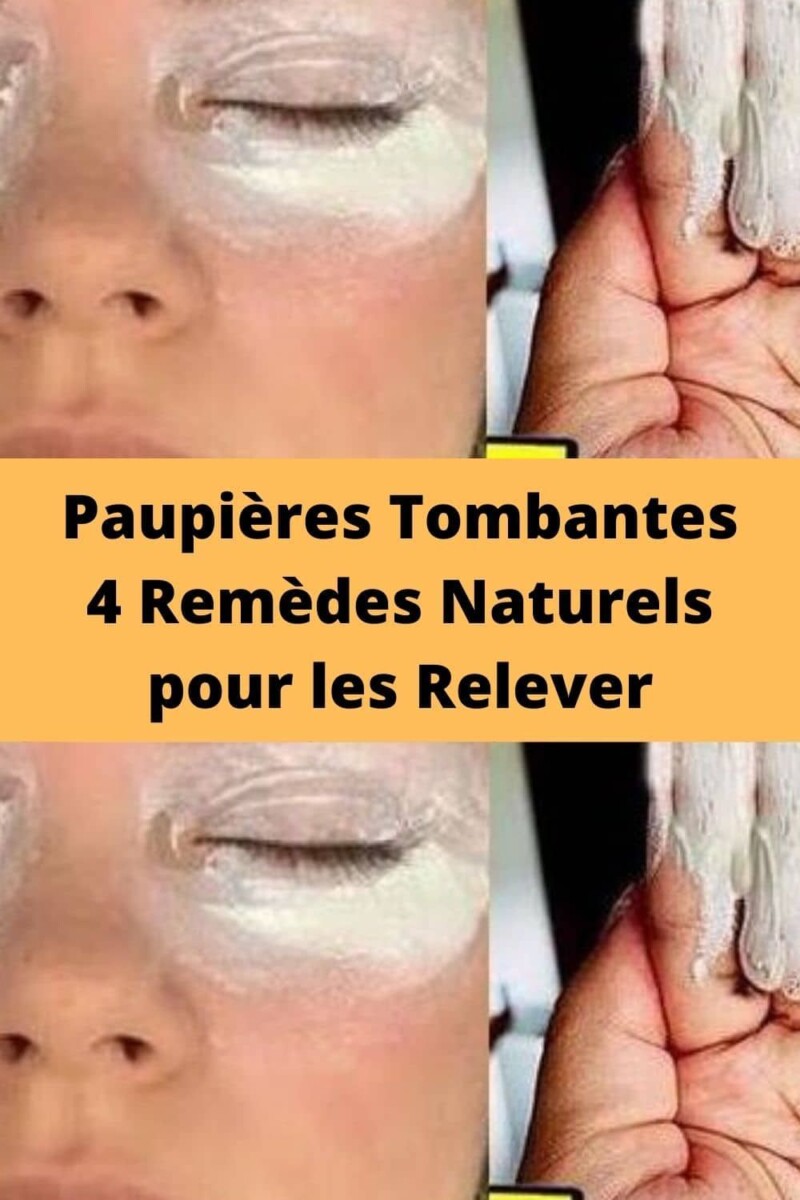 rem&egrave;de paupi&egrave;res gonfl&eacute;es