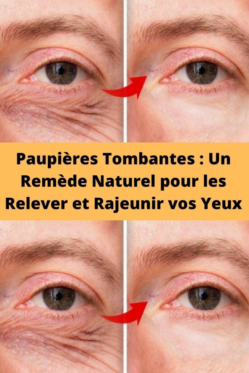 rem&egrave;de paupi&egrave;res gonfl&eacute;es
