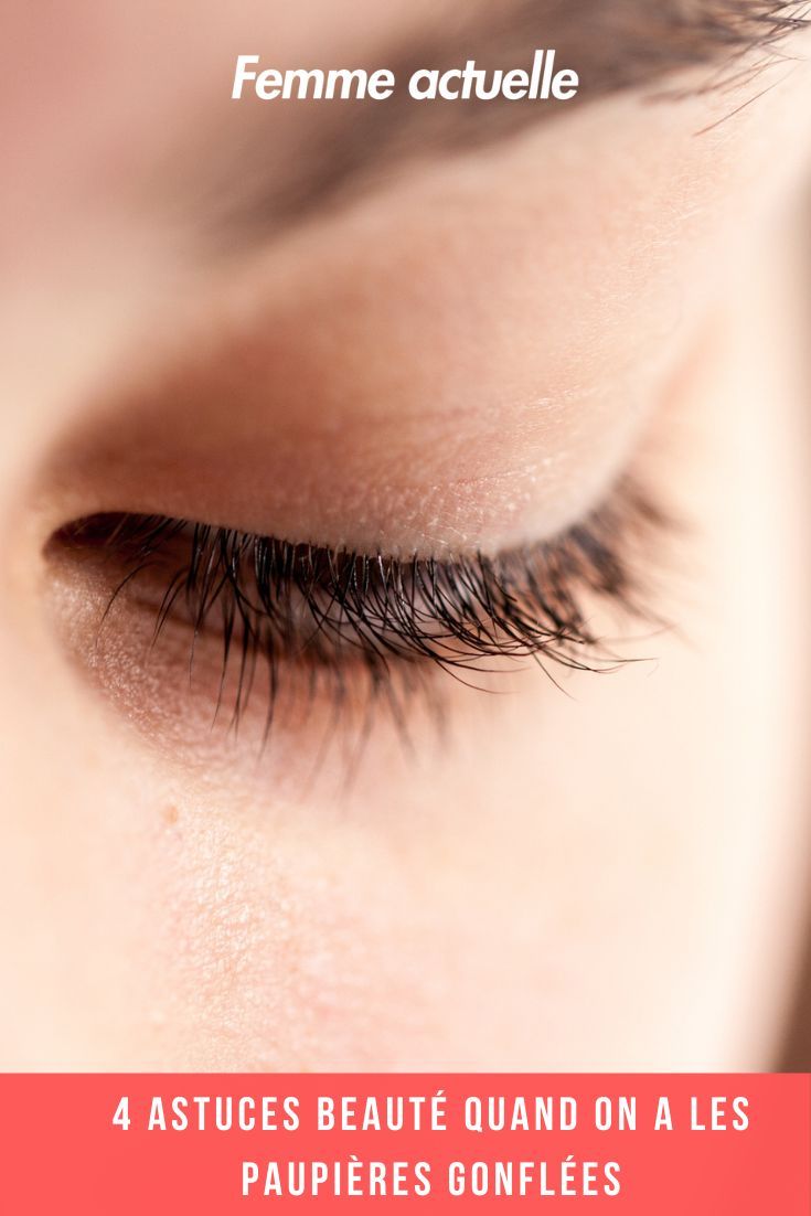 Rem&egrave;de naturel paupi&egrave;res gonfl&eacute;es