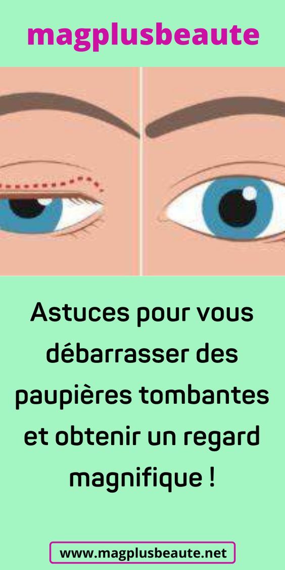 Rem&egrave;de naturel paupi&egrave;res gonfl&eacute;es