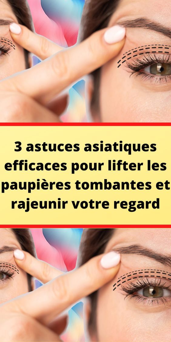 rem&egrave;de paupi&egrave;res gonfl&eacute;es