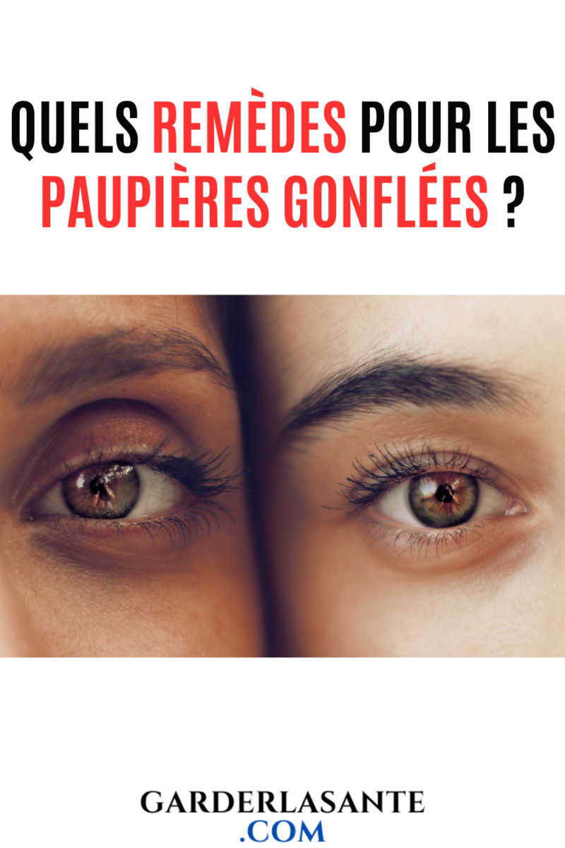 rem&egrave;de paupi&egrave;res gonfl&eacute;es