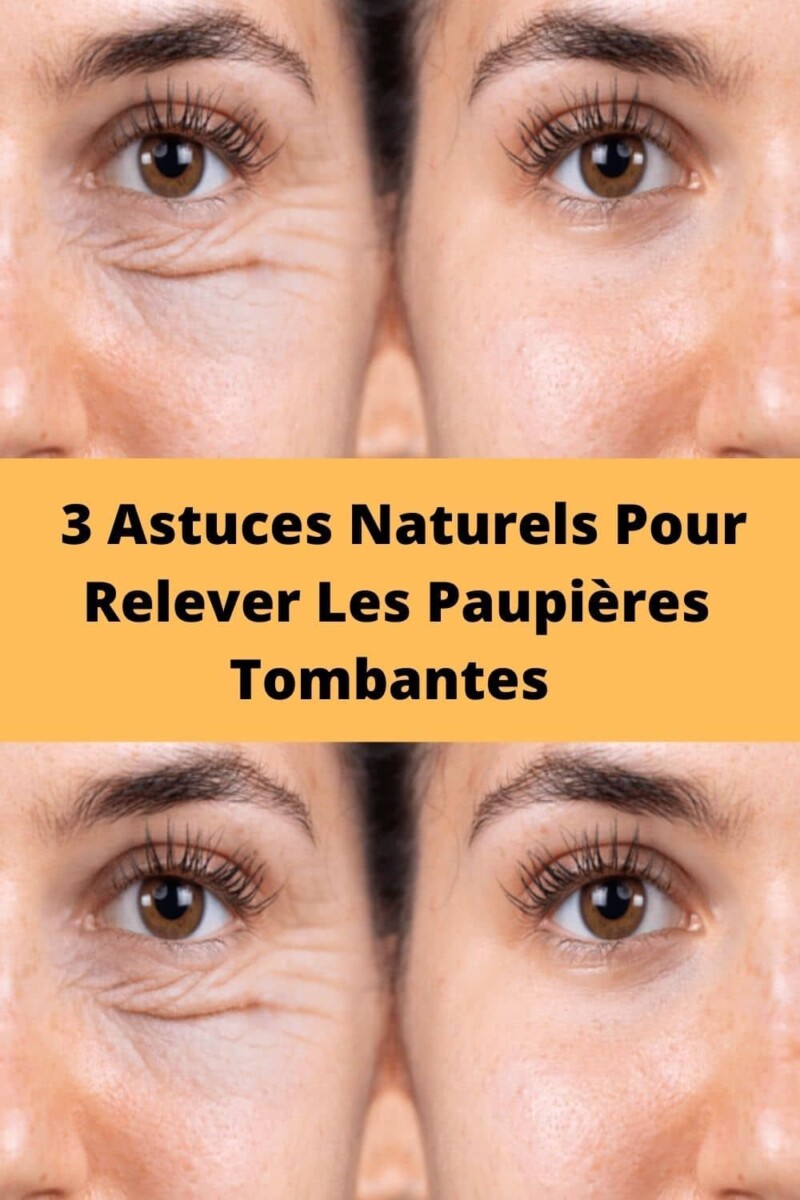 Rem&egrave;de naturel paupi&egrave;res gonfl&eacute;es
